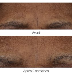 Smart Clinical Repair™ - Anti-Wrinkle Retinoid Balm Smart Clinical Repair™ - Anti-Wrinkle Retinoid Balm